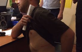 Адвокат оприлюднив фото побитого Ігоря Гуменюка